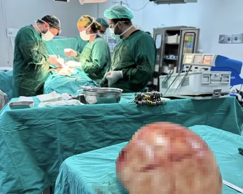 Van’da bir kadının karnından 35 santimetrelik dev kitle çıkarıldı